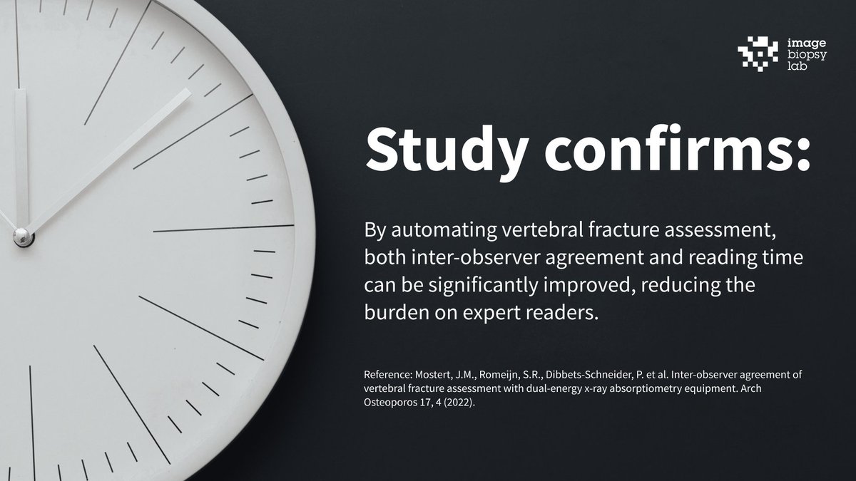 ImageBiopsy Lab (@imagebiopsylab) on Twitter photo Does automated vertebral #fracture assessments help improve inter-observer agreement & decrease reading time and burden on readers?
Read more & find out the last #clinical evidence in the #MSK-#AI study➡️link.springer.com/article/10.100…
#IBLab #aiisthefuture #medicalai <a href="/UniLeidenNews/">Leiden University</a> Does automated vertebral #fracture assessments help improve inter-observer agreement & decrease reading time and burden on readers?
Read more & find out the last #clinical evidence in the #MSK-#AI study➡️link.springer.com/article/10.100…
#IBLab #aiisthefuture #medicalai <a href="/UniLeidenNews/">Leiden University</a>