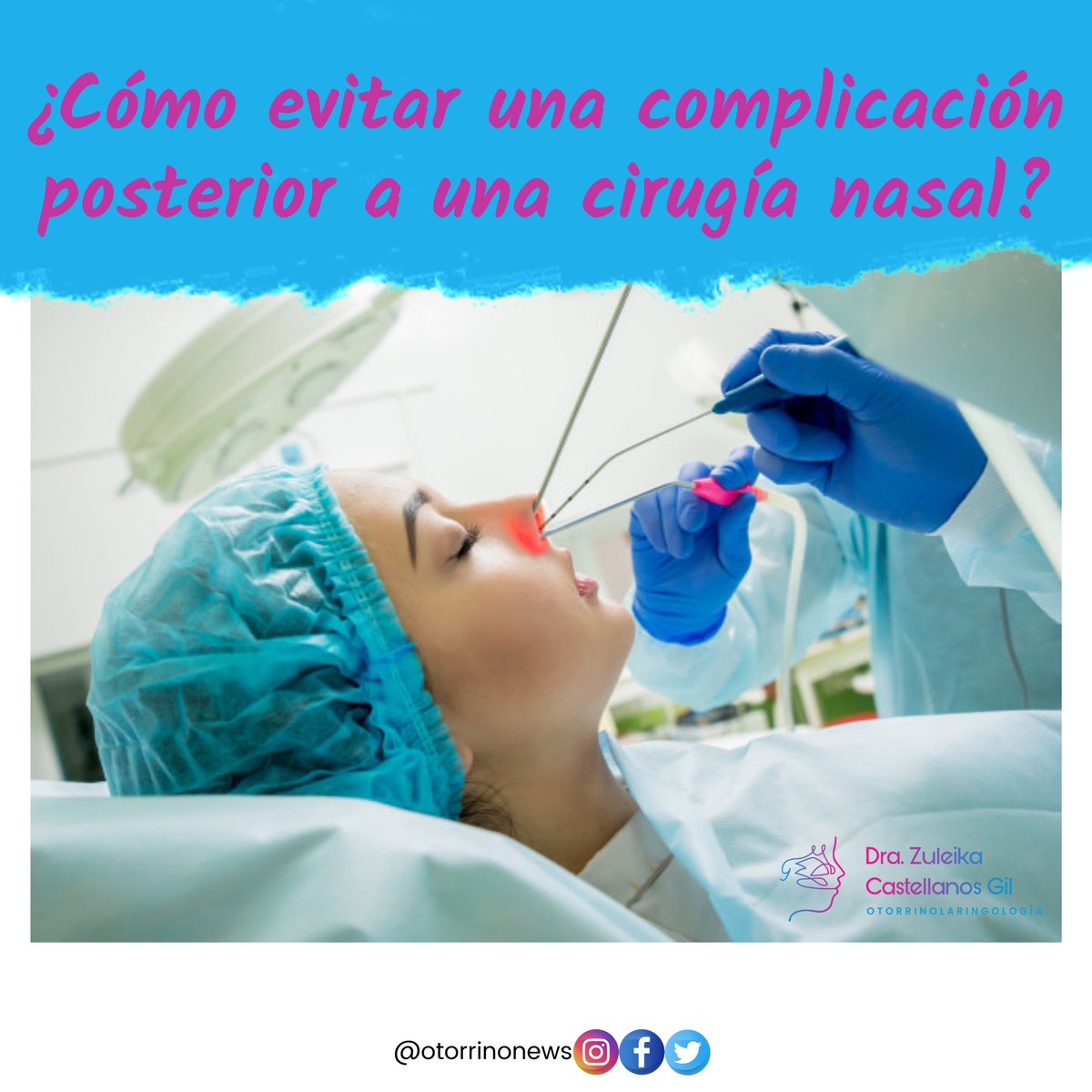 Después de una cirugía nasal es seguir las indicaciones de tu medico como no levantar peso, protegerte del sol, evitar ejercitarte, además del tratamiento medico y siempre estar en comunicación ante cualquier duda o síntoma. la nariz cicatriza muy rápido pero requiere cuidados.