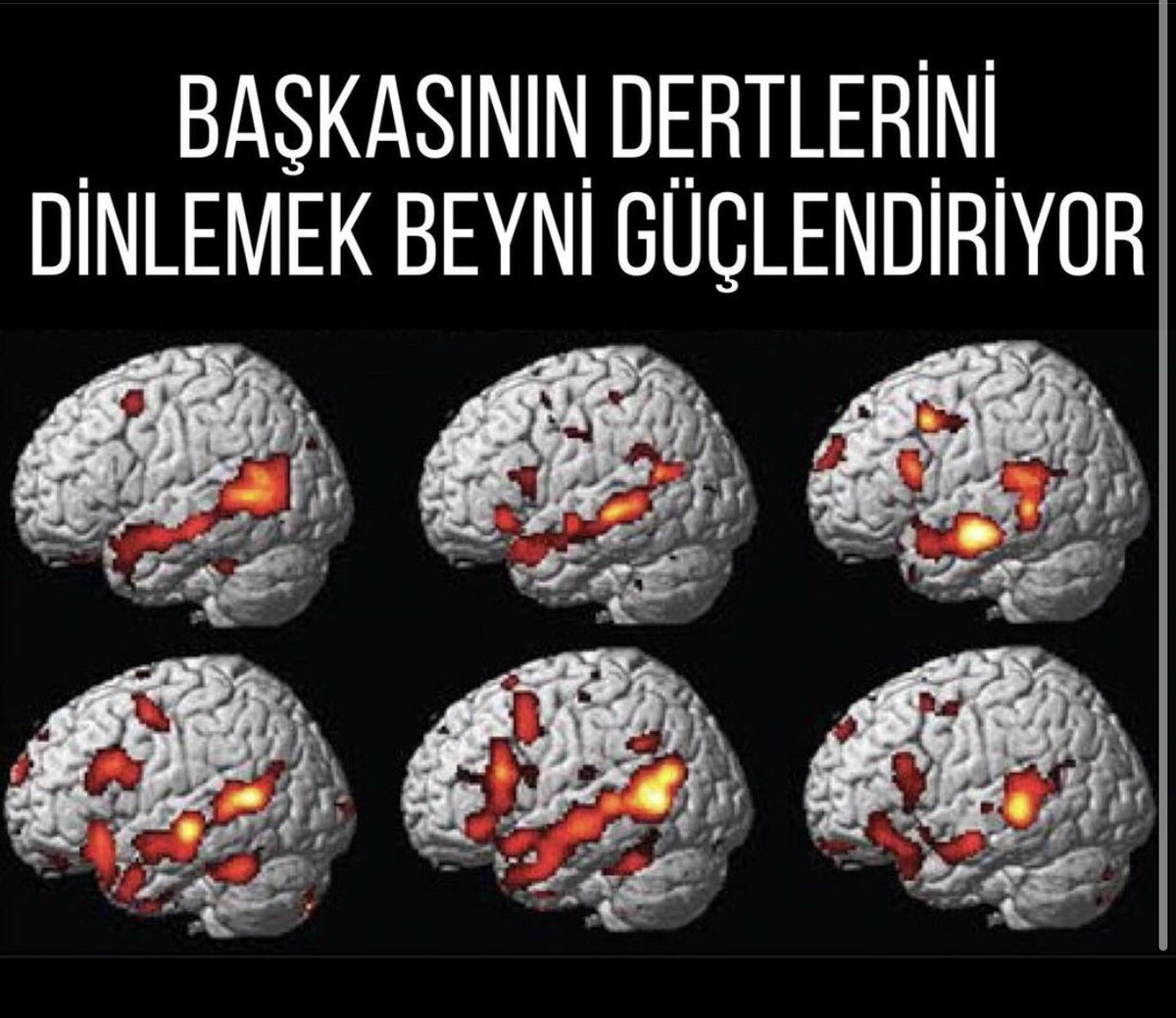 _terapotik's tweet photo. Psikolojik Danışmanların beyni; temsili 💥☄️🎇 https://t.co/GorEwBAtOo