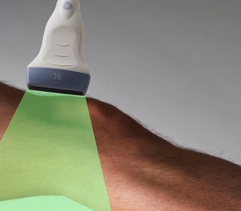 After reviewing our cases from January we have selected a case of unilateral knee swelling to highlight the use of ultrasound in this extremely common ED chief complaint. #POCUS #FOAMed 

downeastem.org/downeastem/202…