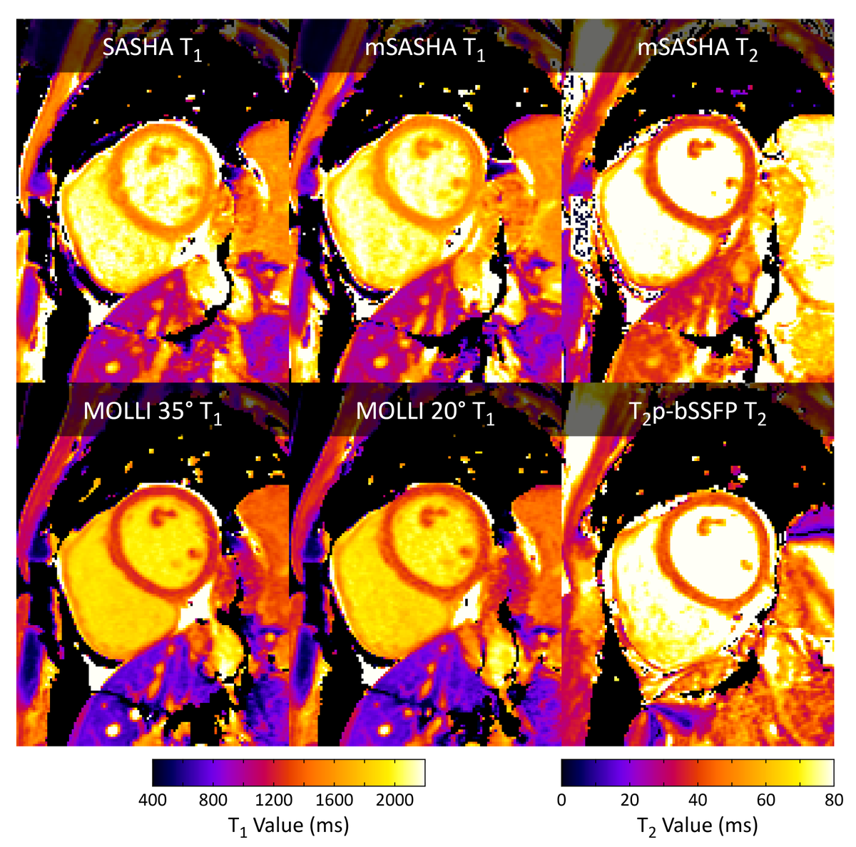 kspaceKelvin's tweet photo. SASHA goes multi-parametric!  T1 and T2 mapping with mSASHA in a single breath-hold is as accurate as SASHA and as precise as MOLLI and T2p-bSSFP.  Have your cake and eat it too! 🍰😋 Thanks to all my co-authors @JAWhiteMD @KellmanPeter et al https://t.co/PKPXeVRayN https://t.co/zj7Mtu78eR