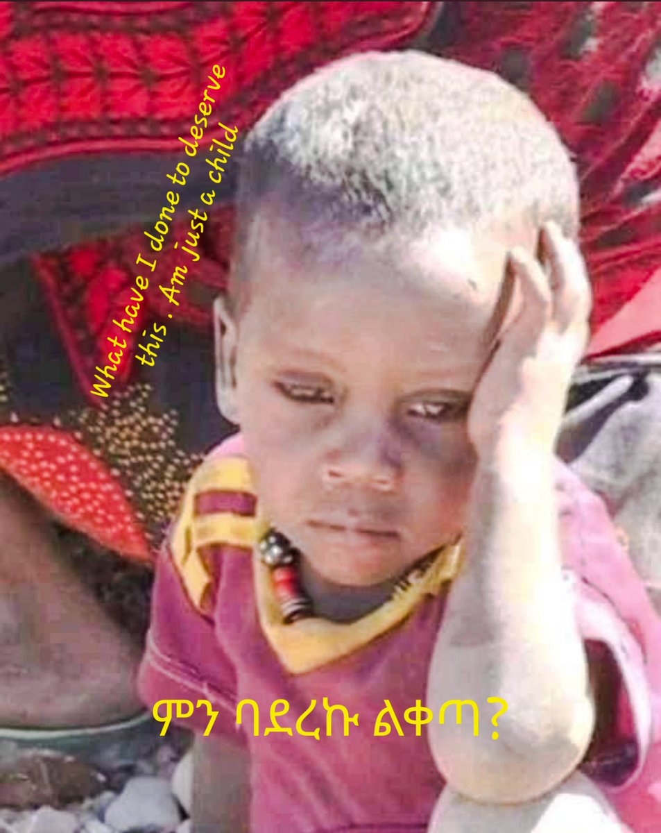 TES28683971's tweet photo. ምን ባደረገ ይጨነቅ በዚህ እድሜው? ስንቶች በእርሱ እድሜ ያሉ ከግድያ የተረፉ ሕጻናት በመቧረቂያ ጊዚያቸው ተርበውና ታርዘው ይቆዝሙ ?
ሕሊና ቢስ ገዳዮችና ፣ አሳዳጆችና አፈናቃዮች እንዲሁም ግድ የለሾች የእነዚህ ወደ እናንተ ይዞራል። ማን ይሆን? https://t.co/g4A56oTPVx