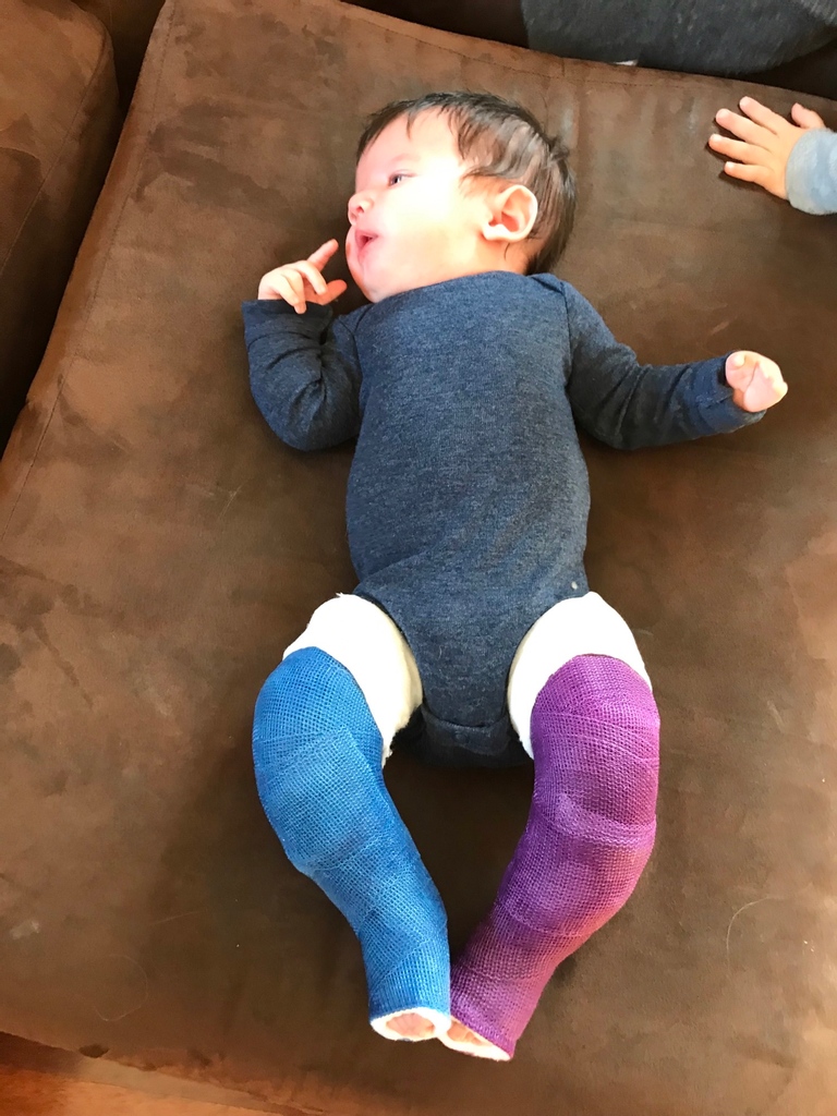MoebiusSyndrome's tweet photo. As we continue to tell your Limitless stories, we would like to introduce you to Nash.
To read Nash's Limitless story, please visit https://t.co/2iCNGPwGP9
#MSFLimitless #moebiussyndrome #disabilitytwitter https://t.co/DVVfG6pX5T