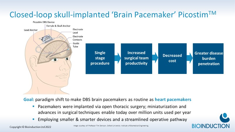neuromodulate's tweet photo. When what if ? ... becomes what is.
Small, Smart, Closed-Loop Cranialized Picostim 🧠⚡ 'Brain Pacemaker' eliminating need for neck tunnelling to a chest pocket
#imaginethepossibilities #dbs #parkinsons #brainpacemaker #DBS @DBSThinktank @stimbrains
https://t.co/8iaRUI52Re https://t.co/1riktN6BZd