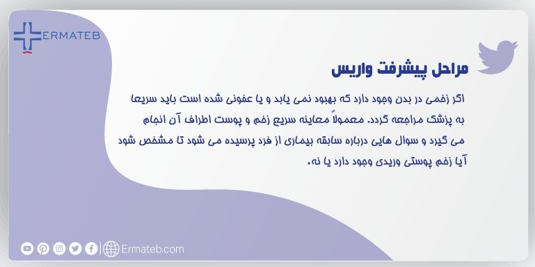 Ermateb_Farsi's tweet photo. 🟢تشخیص #زخمهای_وریدی
اگر زخمی در بدن وجود دارد که بهبود نمی یابد و یا عفونی شده است باید سریعا به پزشک مراجعه گردد.
در برخی موارد پزشک ممکن است آزمایش‌های دیگری مانند عکس‌برداری با اشعه ایکس یا سی‌تی اسکن را برای بررسی دقیق رگ‌ها و ناحیه اطراف زخم تجویز کند.
#ارماطب
#خدمات_پزشکی https://t.co/MbwHec7MWi