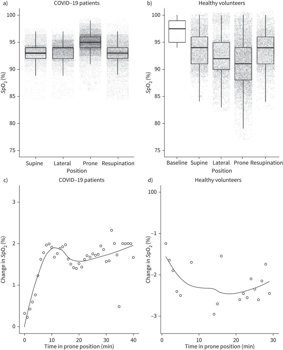 Awake prone positioning in patients with #COVID19 causes a small increase in SpO2 within 10 min of proning but is associated with increased subjective discomfort, and challenges in the identification of hospital patients suitable for the procedure bit.ly/3wg84BC