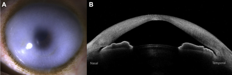 Ophthalmology tweet media