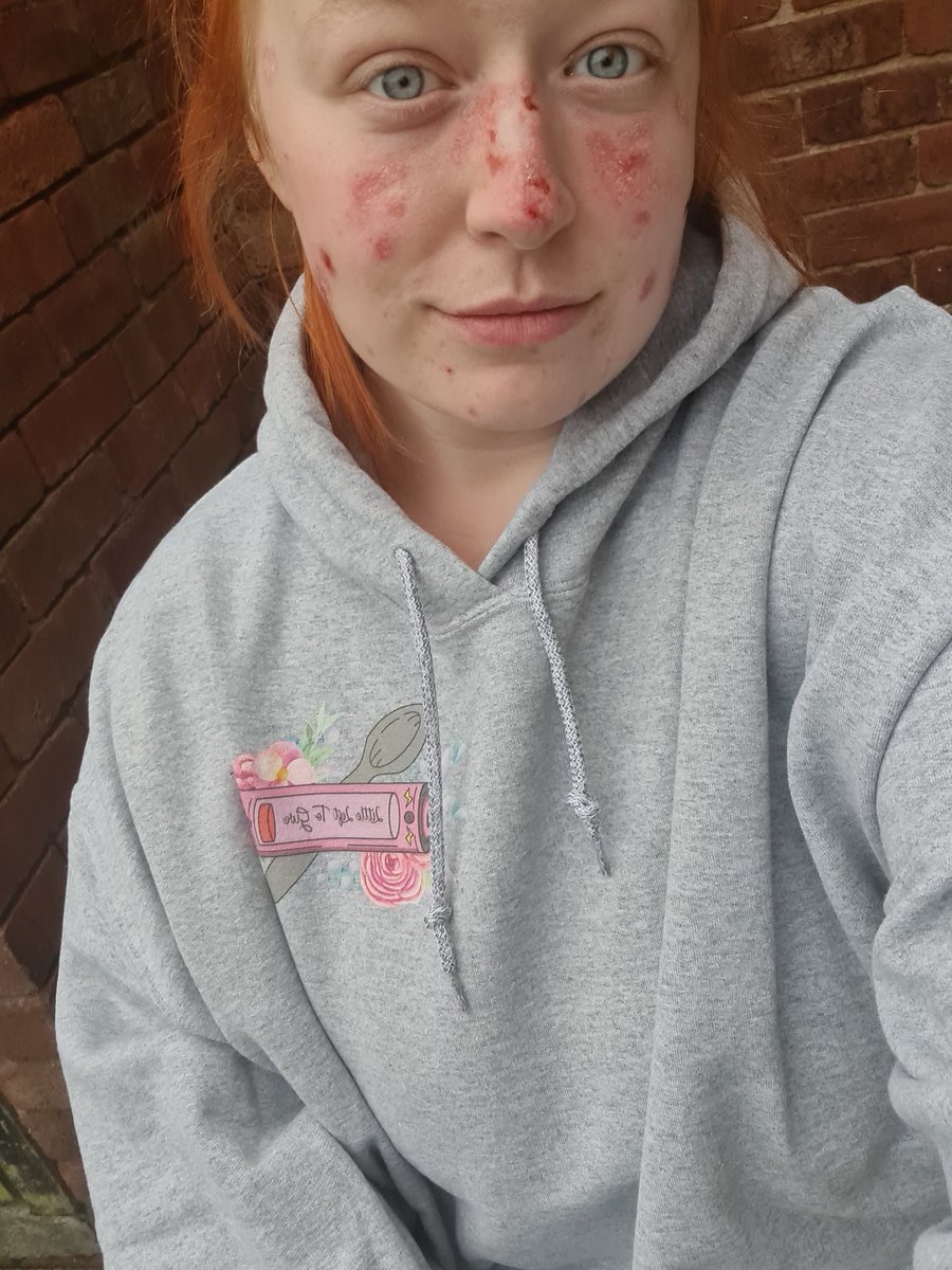 Charliieeexoxo's tweet photo. My chronic illness spoonie design is on Amazon 😁 

It's available on UK and the us :) 

https://t.co/VIQicNSqzR

Please like and retweet it'll mean the world to get my design allowence up 💜💜 

#chronicillness
#SmallBusiness #Spoonies #autoimmune #mentalhealth #ChronicPain https://t.co/r2RAql3Dab