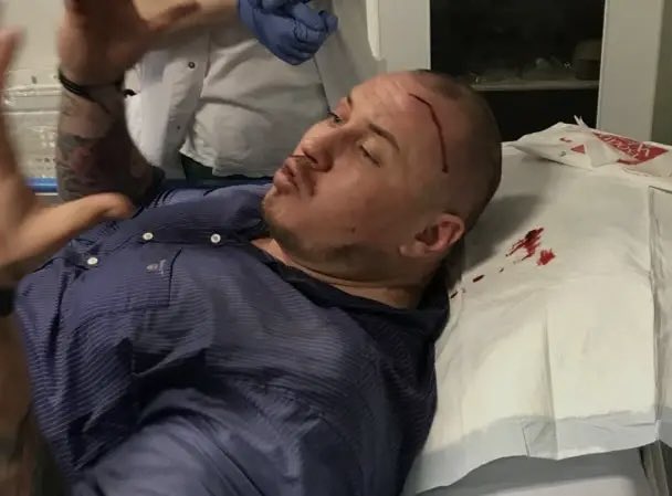 peter hurt send upsells