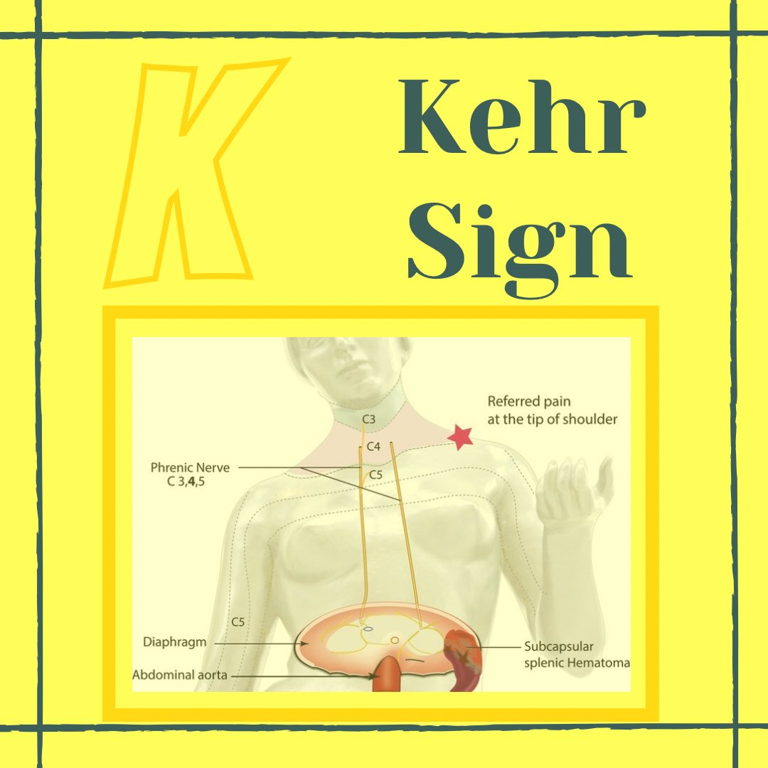 Kehrs Sign Kehrs Sign