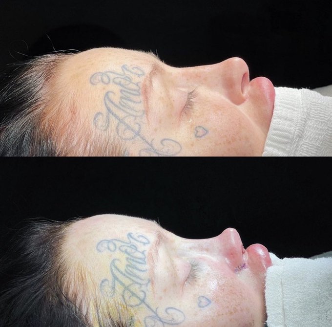 Hi twitter babes❤️ in case u didnt know im currently in recovery for multiple surgeries 🥸💉💉💉 https://t