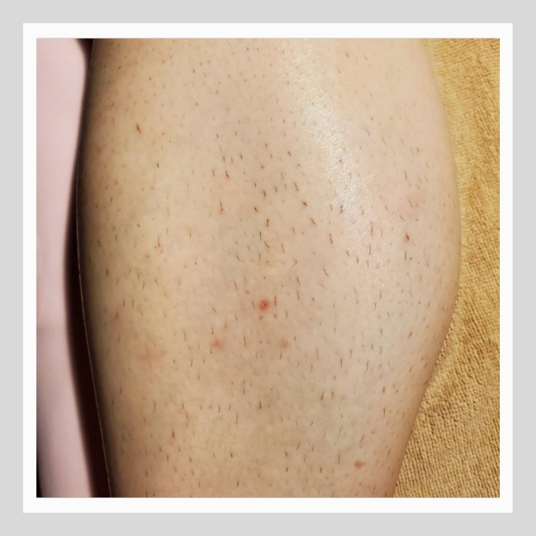 Be Bogoss ボゴス 武蔵小杉のメンズ専門脱毛店 Be Bogoss ボゴス 的 脱毛肌の魅力 アラブへ遠征した十字軍の男たちは 脱毛処理されたアラブ女性の肌の滑らかさ 美しさにすっかり舞い上がり ハイジーナ脱毛を本国に持ち帰ったという話があります