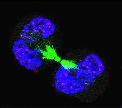 Ceinge's tweet photo. to better understand how alterations of this mechanism may cause diseases like #Cancer
Compartmentalized control of #Cdk1 drives mitotic spindle assembly @CellReports @Ceinge
https://t.co/CfCP2W1OUz https://t.co/IGZPIZpWYj