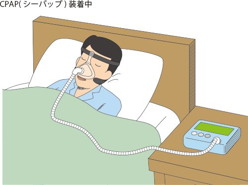 人工呼吸器のtwitterイラスト検索結果