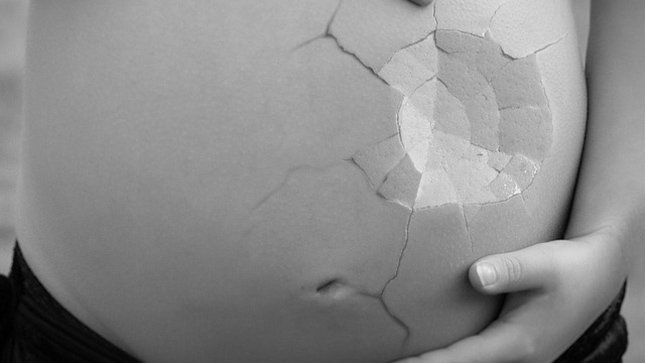 annenviva13's tweet photo. #Salvadoreña puesta en libertad tras 10 años encarcelada por sufrir una emergencia obstétrica que le provocó #aborto que es tipificado en #ElSalvador como homicidio agravado. Agrupación Ciudadana por Despenalización del Aborto celebra que errónea sentencia de 30 años terminó. https://t.co/Gweoy4tb9D