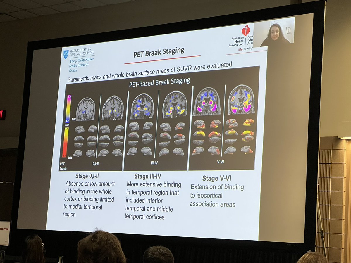 Edip Gurol (@guroledip) on Twitter photo Dr. <a href="/GokcalElif/">Elif Gokcal, MD</a> on tau in <a href="/CAA_Disease/">Amyloid Angiopathy</a> - #ISC22 <a href="/SMGreenbergNeur/">Steven M. Greenberg MD, PhD</a> <a href="/AHAMeetings/">AHAMeetings</a> Dr. <a href="/GokcalElif/">Elif Gokcal, MD</a> on tau in <a href="/CAA_Disease/">Amyloid Angiopathy</a> - #ISC22 <a href="/SMGreenbergNeur/">Steven M. Greenberg MD, PhD</a> <a href="/AHAMeetings/">AHAMeetings</a>