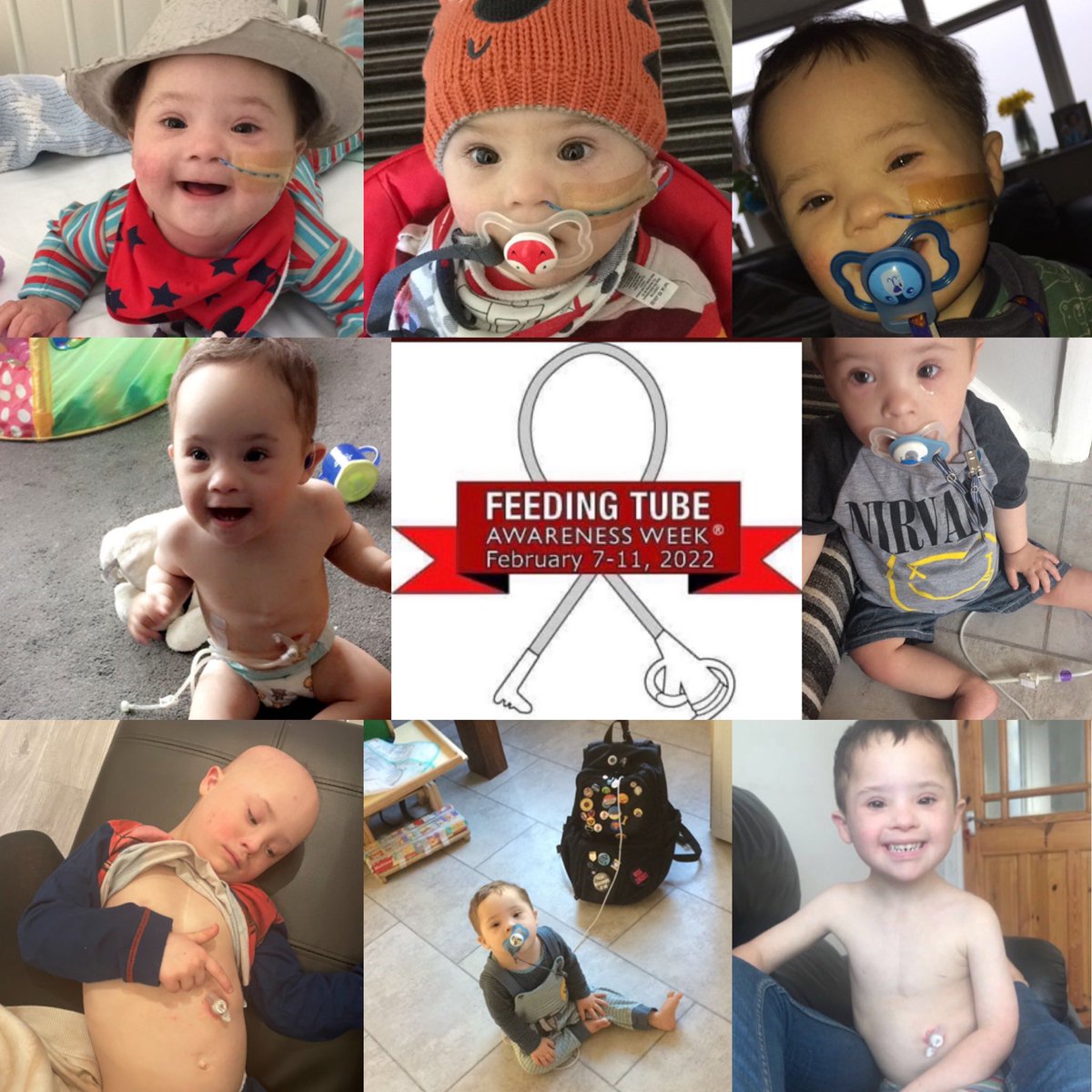 csclaire25's tweet photo. My tubie Noah , he’s had #ngtube #gjtube #gtube #minibutton & a #mickeybutton is the one he currently has & he calls it his BOB , #feedingtubeawarenessweek https://t.co/NGVq9FhDAa