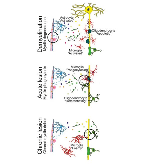 LenaSpieth's tweet photo. Is dietary supplementation the way in MS therapy? 🫒Check out our new review about local cholesterol metabolism in remyelination. @TrendsNeuro 🥳
https://t.co/Vjt1ENXbg4 https://t.co/tY3mFRYW9u