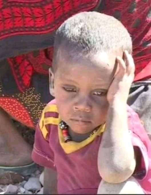 son1_afar's tweet photo. #A picture 👉Is Worth #Athousand👉Words 👈
#A displaced👉Child 👉in👉In AFAR Region 👉by TPlf#terrorist group 👈 https://t.co/do7tF5IMza