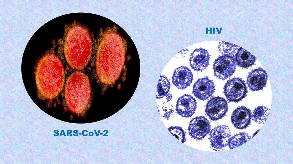 Strange_Sounds's tweet photo. The MSM prepares the public for incoming AIDS outbreak - COVID vaccine link? #news #health #HIV #conpiracy #vaccine
https://t.co/5UhLVt2s0i via @Strange_Sounds https://t.co/dy030fnXX7