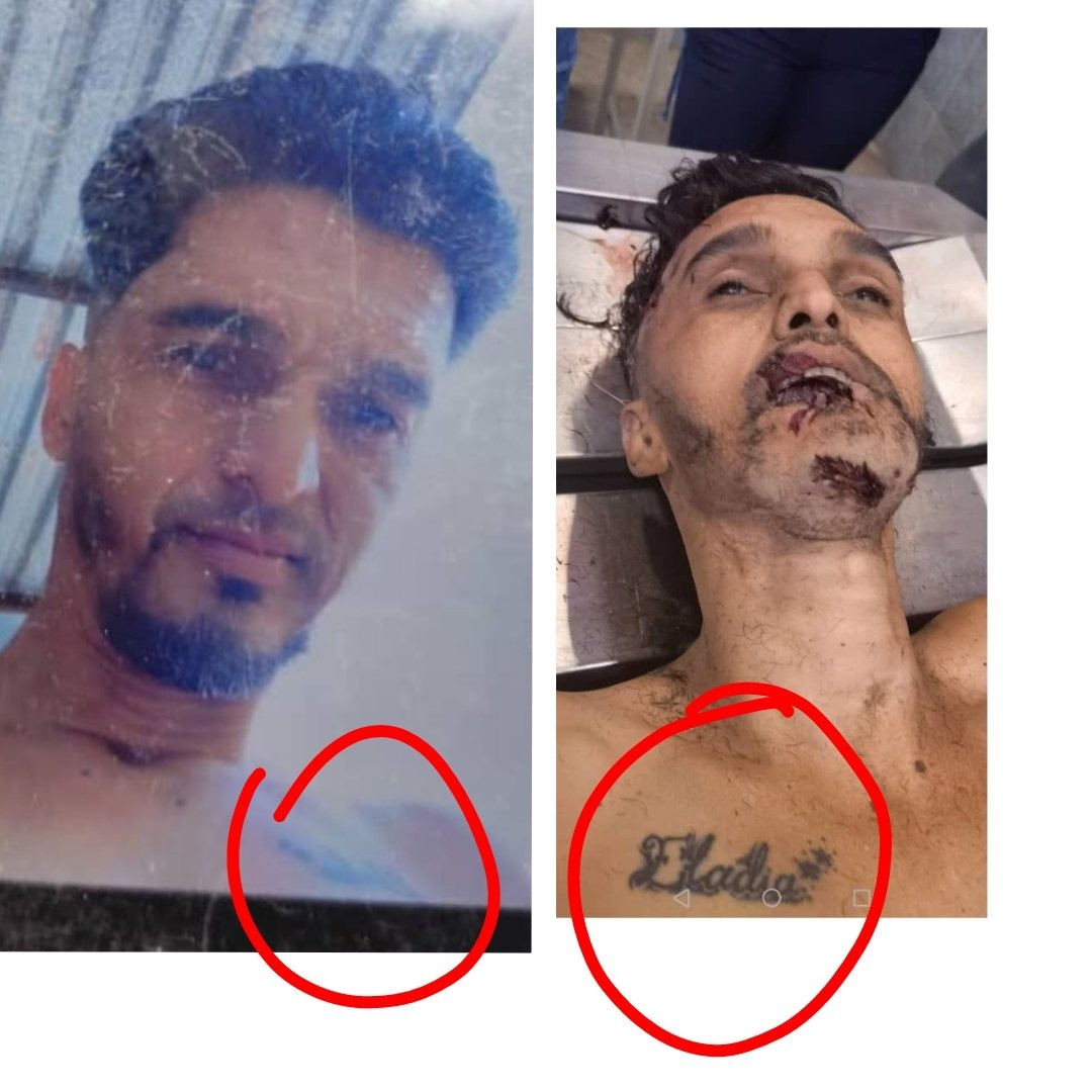 Y se filtraron las fotos de Carlos Luis Revette, alias el Koki... ahora dicen q no murió...