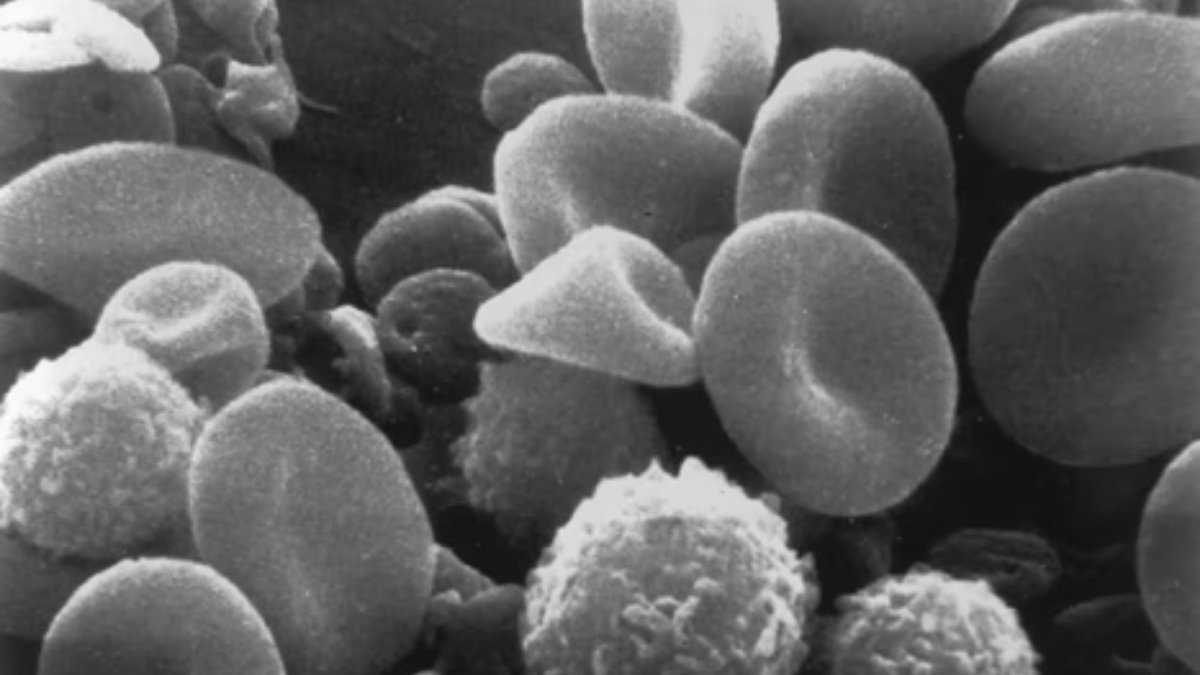 CBR_UBC's tweet photo. 🩸 RESEARCH: Paper from #KastrupLab & collaborators, with 1st author Lih Jiin Juang
"Suppression of fibrin(ogen)-driven pathologies through controlled knockdown by lipid #nanoparticle delivery of #siRNA" #GeneTherapy
📝Read it in @BloodJournal: https://t.co/ZkjC3Ghyxx https://t.co/9rqmLwibT6