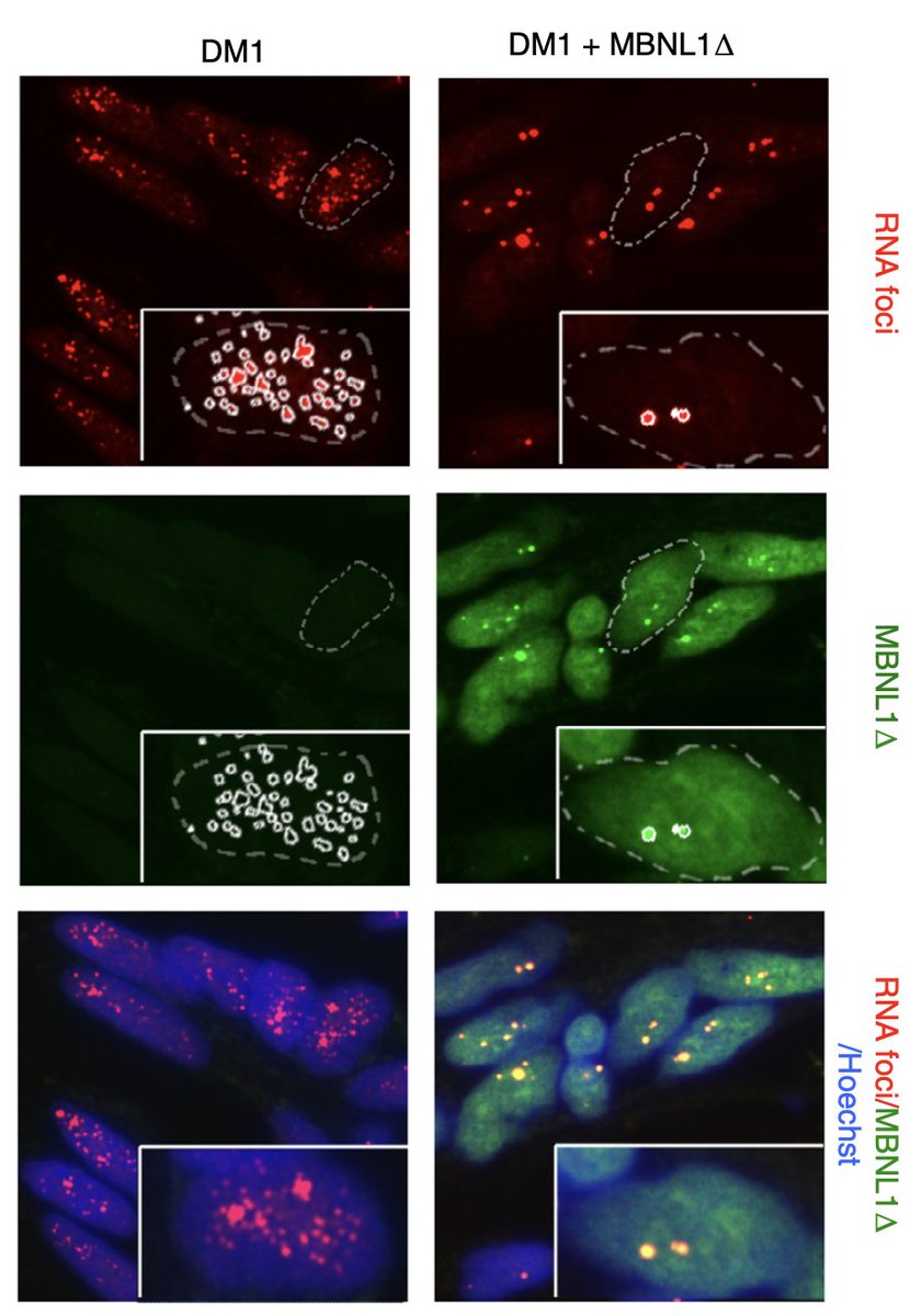 natBME's tweet photo. Reversal of RNA toxicity in myotonic dystrophy via a decoy RNA-binding protein with high affinity for expanded CUG repeats

https://t.co/aB81SucCvl https://t.co/VctuOSU848
