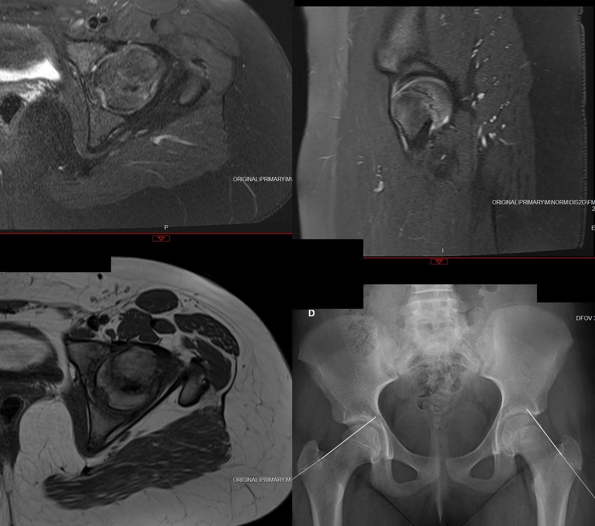 A rare diagnoses is very cool, but I think a classic case is so beautiful!