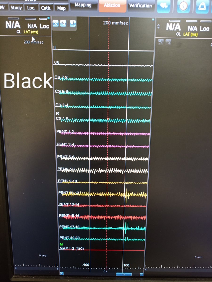 bej14090312's tweet photo. This is why I prefer Dark gray. #EPeeps https://t.co/r7K0ZsFJgF