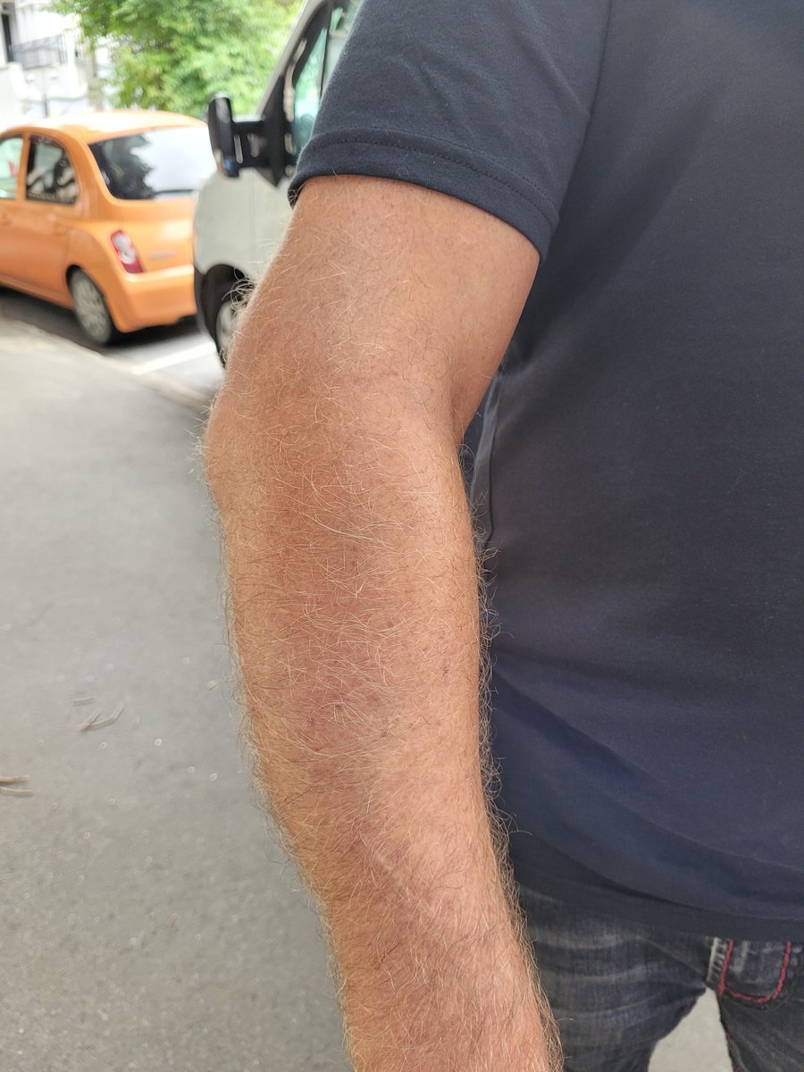 Police brutality Beehive 
New Zealand .Peaceful Poppa slammed down