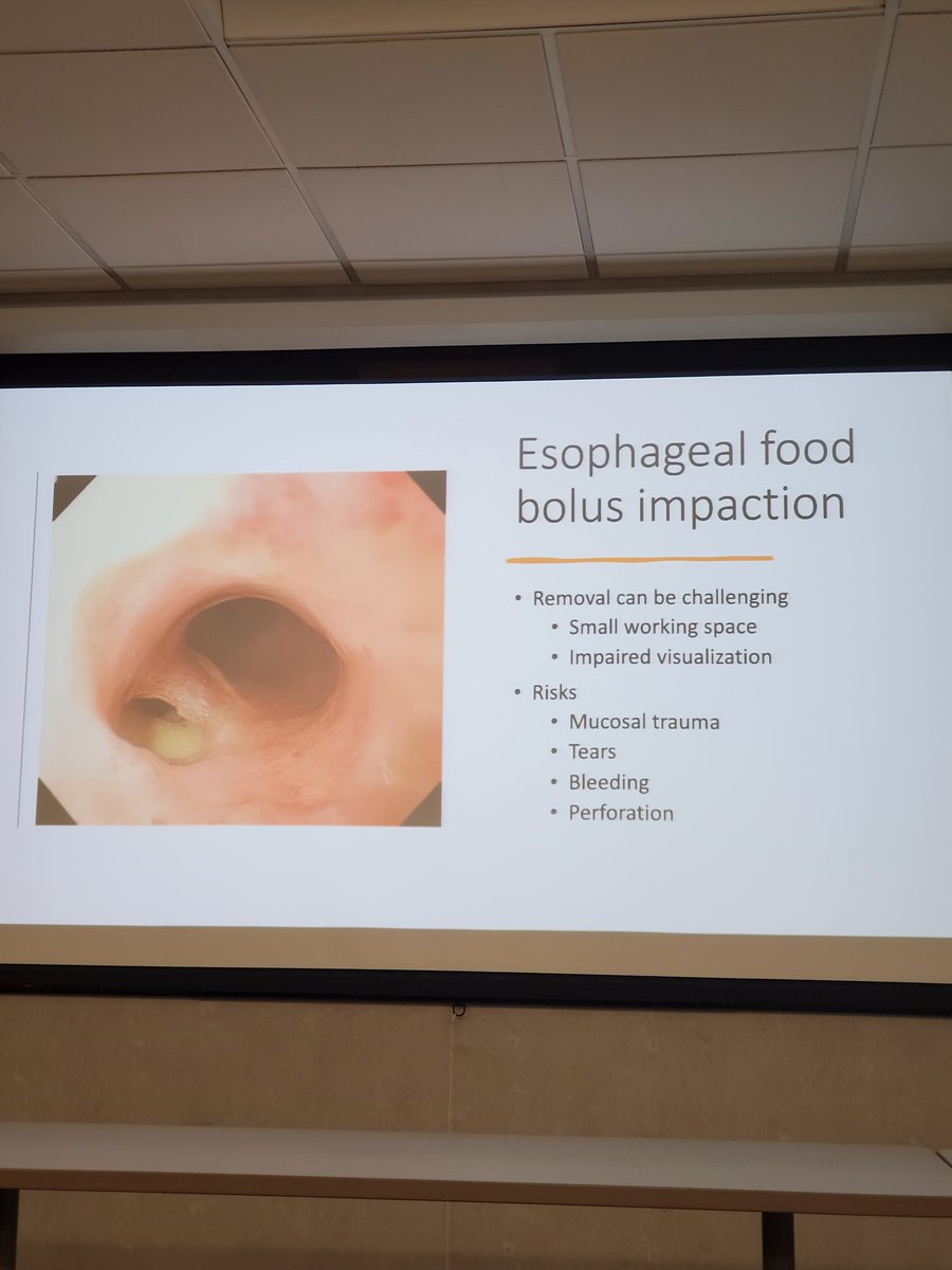 HFHGastroFellow's tweet photo. Thanks @FakePBrown87 for leading today's journal club! #capgang "This multicenter randomized controlled trial confirmed that the cap-assisted technique is more effective and less costly than the conventional approach and should be first-line treatment for esophageal FBI." https://t.co/mJ0SqjDAFS