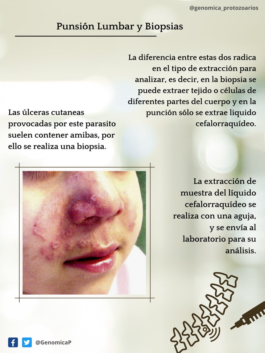 GenomicaP's tweet photo. Normalmente, la sintomatología se confunde con otro tipo de afecciones como infecciones
por otro microorganismo (bacterias o virus principalmente) y tumores. Es por este motivo
que EAG suele diagnosticarse mayormente tras el fallecimiento del paciente (post-mortem).
#amibas #ega https://t.co/c0h6pNf50q