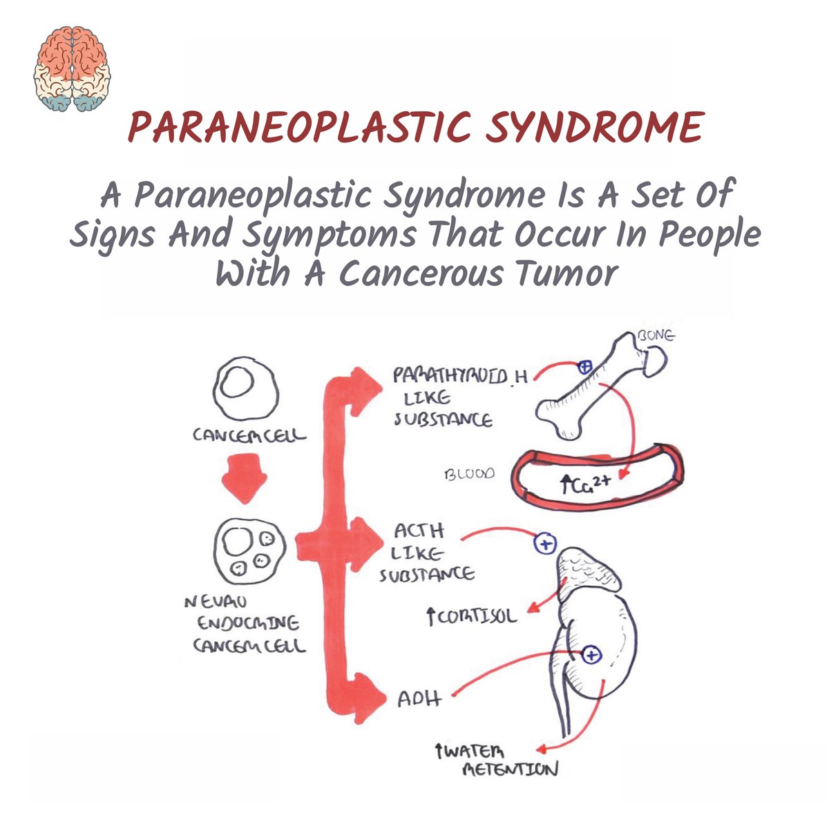 armandohasudung's tweet photo. Lung cancer is classified into small cell carcinoma & non-small cell carcinoma based on the microscopic appearance.
Read more @
https://t.co/zIWDcty283
https://t.co/URFtDeQ2oj
#lungcancer #oncology #lungdisease #chemotherapy #radiotherapy #lungs #oversmoking #secondhandsmoking https://t.co/K9zH3m9sjq