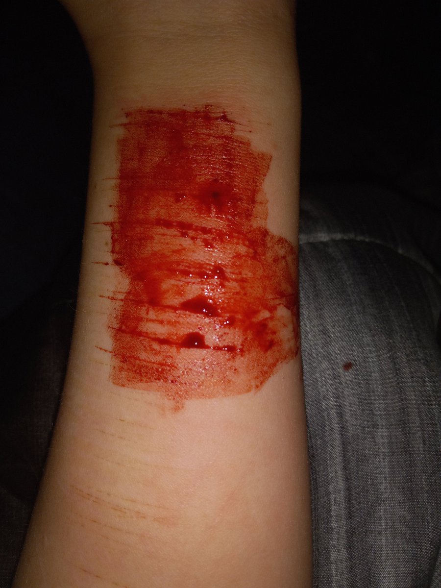 LSER66722307's tweet photo. TW//SH
.
.
.
.
.
.
.
.
.
.
.
IM BACK BITCHESS
redbreadtwt 198twt sh twt ouchietwt catscratchestwt barcodetwt styro twt https://t.co/DWByEAUjrN