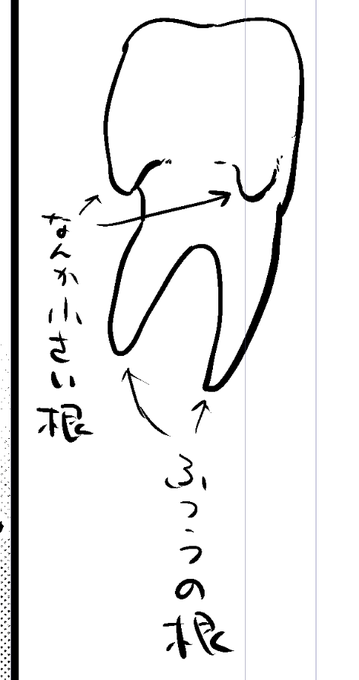 一昨年親知らず抜いてもらったんだけど1時間くらいかかって歯医者さんも汗だくだし僕もほぼ死んでて、抜けたら根っこが4本あって、ググったら『歯の根は2本、多くて3本あります』って書いてあって「多い!」って思った。 