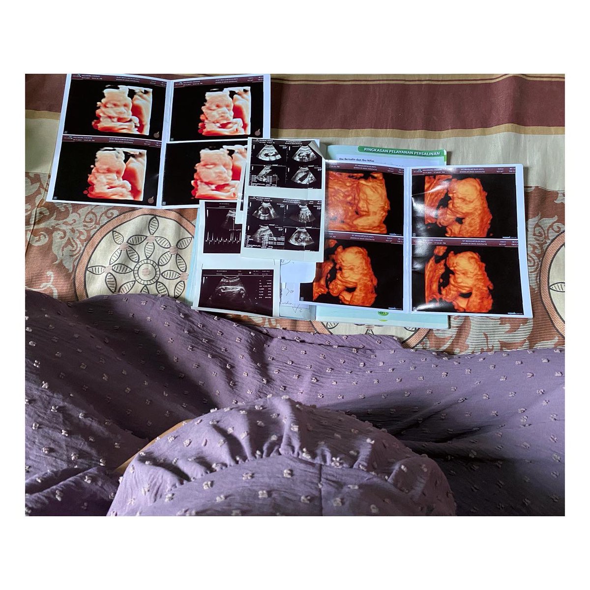 imashishy's tweet photo. I can't believe my own body has given me the greatest gift of my life ❣️ 
Already in love with our babyboy 🥰 https://t.co/Iv01ERkuv8