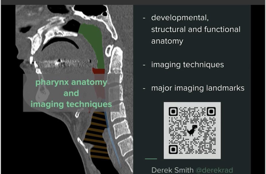 BSHNI_UK's tweet photo. Great session on Imaging of the Pharynx. Thank you @DrNeuroRad @derekrad @elizal_CDDFT  &amp; Corrine Binns https://t.co/2SQmXMtXhe