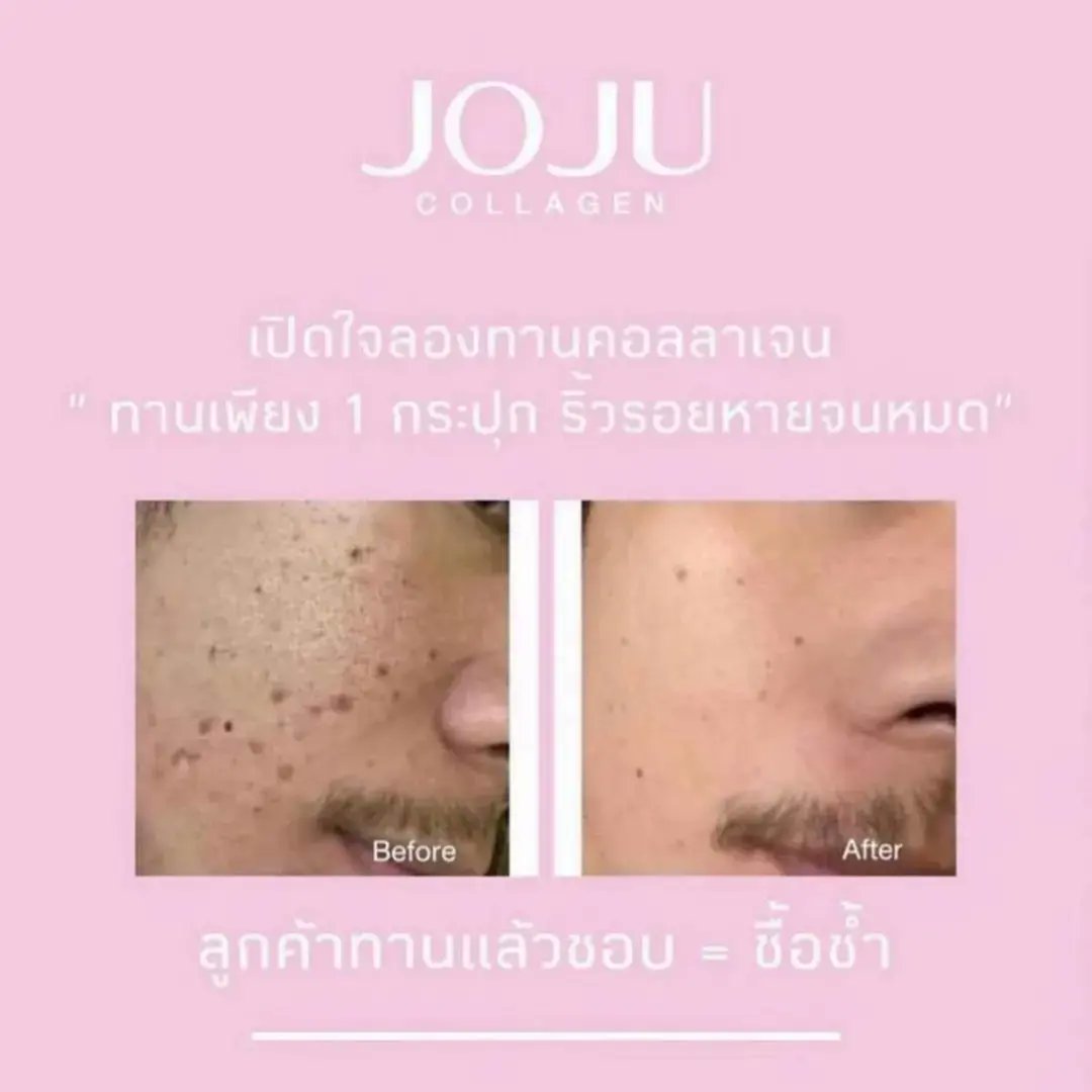636Poo's tweet photo. ผู้ชายทานโจจู #โจจูคอลลาเจน https://t.co/NZqYneHidr