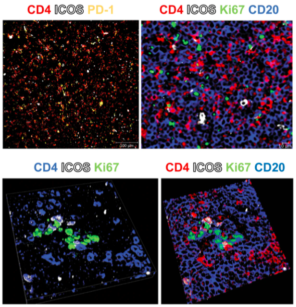 LeukemiaJnl's tweet photo. Activation and expansion of T-follicular helper cells in chronic lymphocytic leukemia nurselike cell co-cultures
Read for free using #SharedIt: https://t.co/Wd4IaOCZU9
#Cancermicroenvironment #Chroniclymphocyticleukaemia https://t.co/Ova75bd7Bo