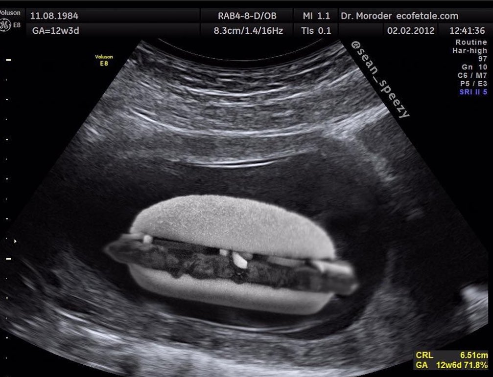 arkadaşlar, ben de hamileyim. :,)