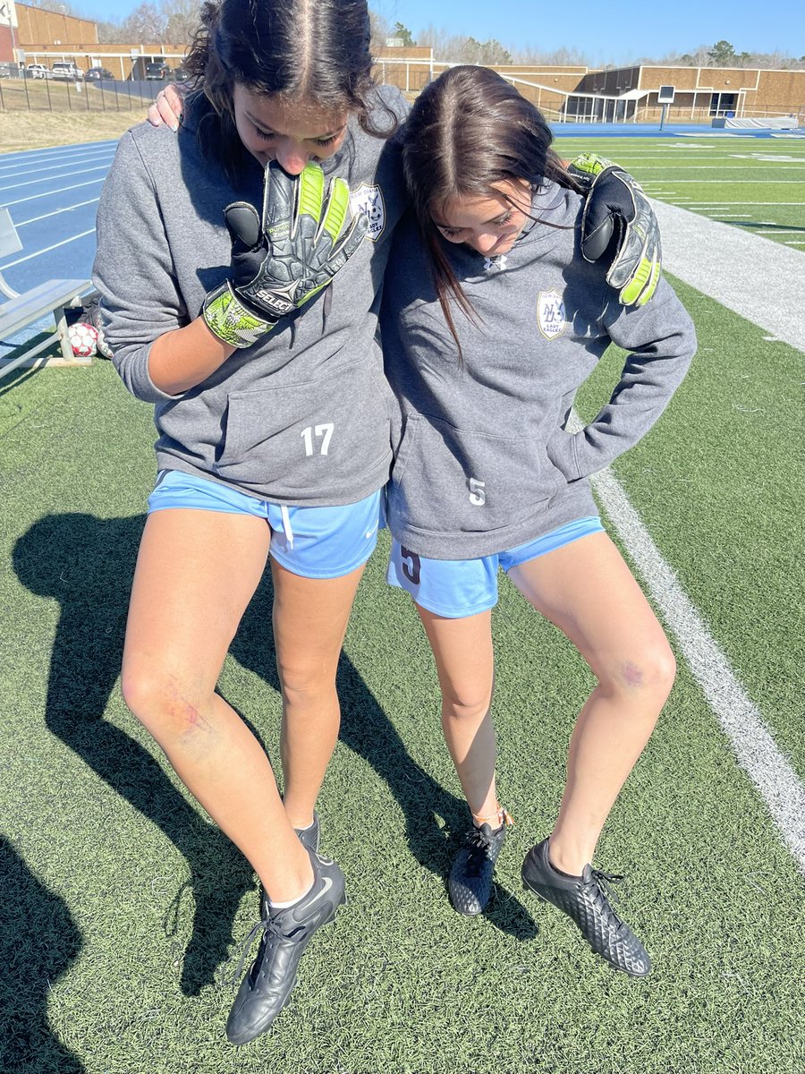 NewDianaHighSc1's tweet photo. #NDLES Chloe and Matty want to know who has the best bruise… vote in our poll!! ⚽️💙 https://t.co/C9mmbac3A5