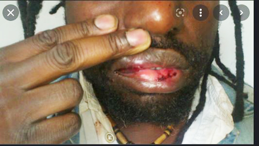 intextojournal's tweet photo. Violence policière: Montréal refuse de payer $115000 à Didier Berry https://t.co/NHcBCqMLUf https://t.co/xpw1lJOH3M