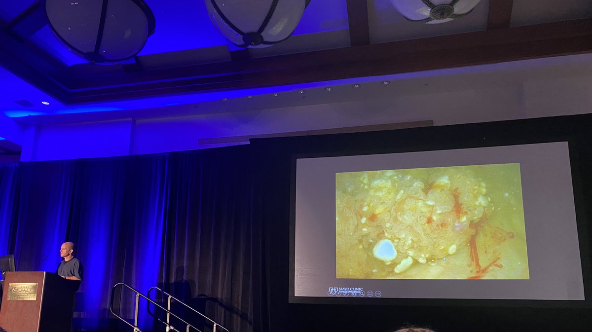 candacegranberg's tweet photo. Transplant doc #PatrickDean gave a nice summary of complications (dx & management) and candidacy for transplant after urologic cancer. @MayoTransplant @MayoUrology #MayoUroHawaii22 https://t.co/jN5OusuTqt