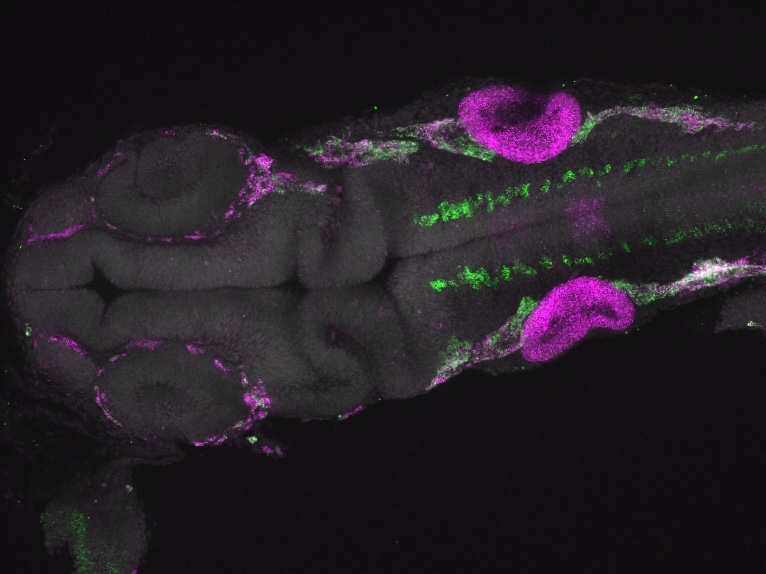 Aleksandra Marconi (@marconi_aleks) on Twitter photo Fresh off the confocal for a good end to #FluorescenceFriday in <a href="/evomorpholab/">Morphological evolution lab</a> #cichlids #HCR Fresh off the confocal for a good end to #FluorescenceFriday in <a href="/evomorpholab/">Morphological evolution lab</a> #cichlids #HCR