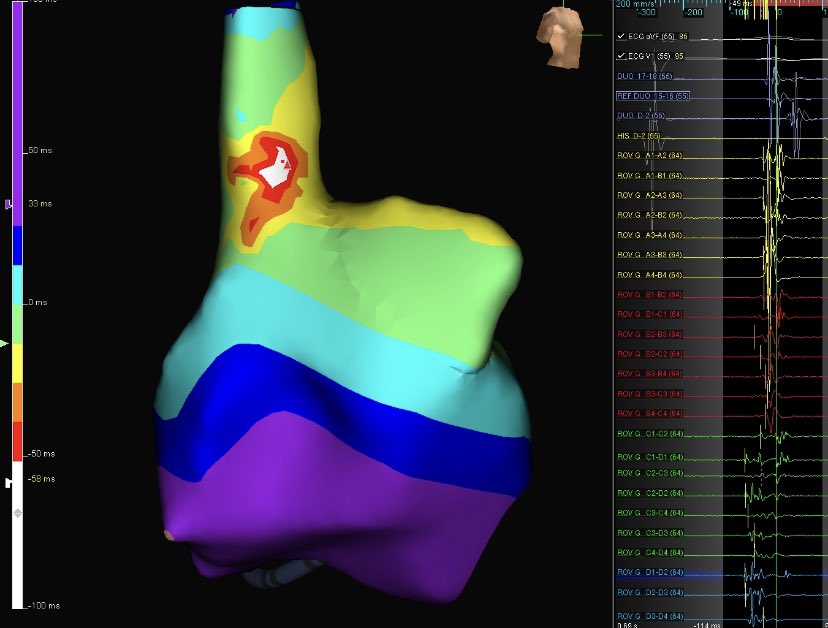 Jason Herzfeld tweet media