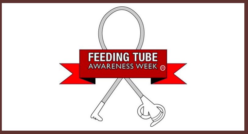 <a href="/HBKidsHospital/">Holland Bloorview</a> specialist Dr. Smile &amp; R Perlman talk about considerations around #Autism &amp; Feeding Tubes. 

A thought provoking and balanced talk. 

<a href="/silvanaoppedis2/">silvana oppedisano</a> #SKTubeFeeding <a href="/Sanj_Mahant/">Sanjay Mahant</a>