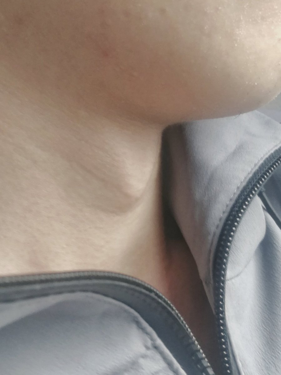 SCNU0729's tweet photo. This huge adam's apple belongs to one of my friends who comes from Shaanxi. Three years ago I took these photos when he was sleeping deeply on the bus. https://t.co/JBXbdgGuu6