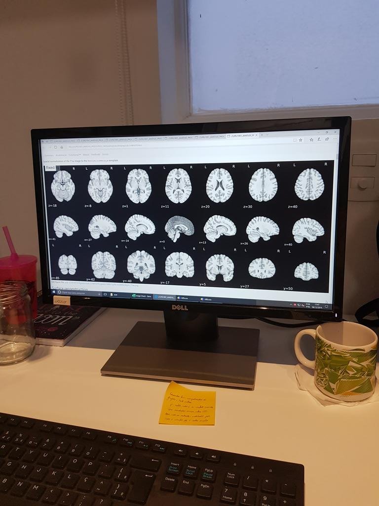 laportmc's tweet image. Sou bióloga pela UERJ e pesquiso neurociência social 🧠❤️

Uso dados comportamentais e de fMRI pra tentar entender melhor o ser humano e como ele interage no mundo! 👩‍💻

✨ah, e também divulgo um cadinho disso no meu instagram✨
 #DiaInternacionalDeMulheresEMeninasNaCiencia