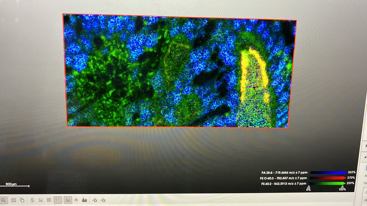 educhicano's tweet photo. #RT @imaging_ms: Simply amazing! #MSImaging from clams (Scrobicularia plana), lipids negative mode with ID 😱. 20um lateral res. @IMIBIC Mass Spectrometry Unit https://t.co/IZJ365IPWk