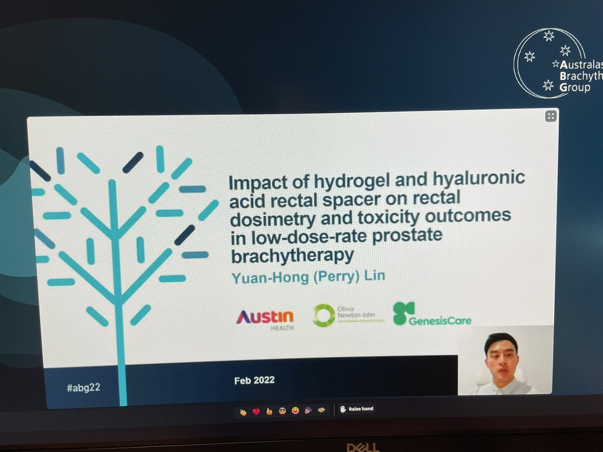 Carminia Lapuz (@carminialapuz) on Twitter photo Rising star soon-to-be #radonc registrar <a href="/PerryLin612/">Perry Lin</a> gives us a double presentation at #ABG22 on rectal spacer in LDR prostate #brachy - dosimetry improvements and toxicity outcomes. π <a href="/mikechao/">mike chao</a> <a href="/FarshadForoudi/">Farshad Foroudi</a> <a href="/AusBrachy/">Australasian Brachytherapy Group</a> <a href="/JPoderMedPhys/">Joel Poder</a> <a href="/sylviahanna18/">Sylvia Hanna</a> <a href="/sylvia_vandyk/">Sylvia van Dyk</a> #pcsm Rising star soon-to-be #radonc registrar <a href="/PerryLin612/">Perry Lin</a> gives us a double presentation at #ABG22 on rectal spacer in LDR prostate #brachy - dosimetry improvements and toxicity outcomes. π <a href="/mikechao/">mike chao</a> <a href="/FarshadForoudi/">Farshad Foroudi</a> <a href="/AusBrachy/">Australasian Brachytherapy Group</a> <a href="/JPoderMedPhys/">Joel Poder</a> <a href="/sylviahanna18/">Sylvia Hanna</a> <a href="/sylvia_vandyk/">Sylvia van Dyk</a> #pcsm
